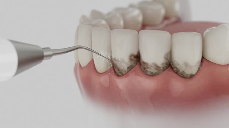 Trusted Root Canal Treatment service in Watsonville, CA - Dentist Open Now
